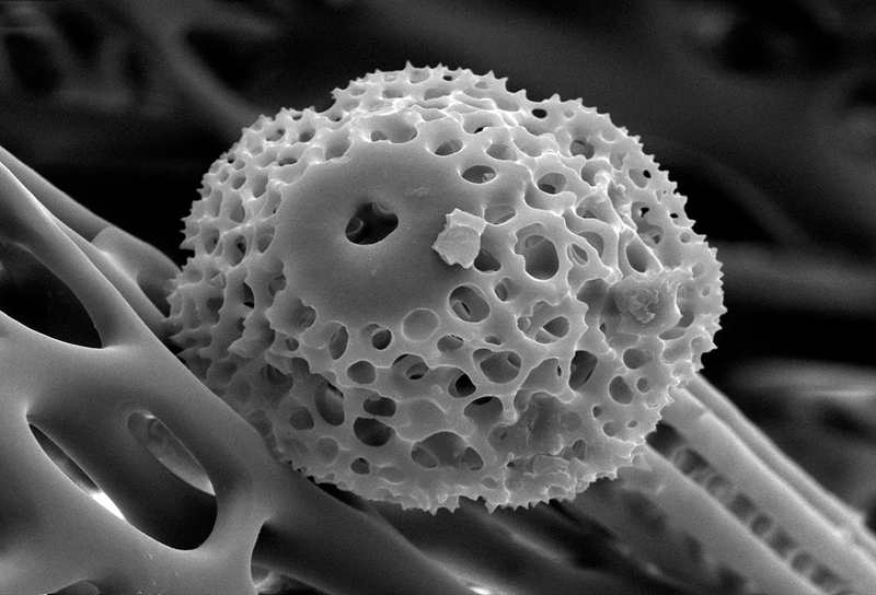 Illustration for article titled Photos of the Amazing and Gruesome World Under a Microscope